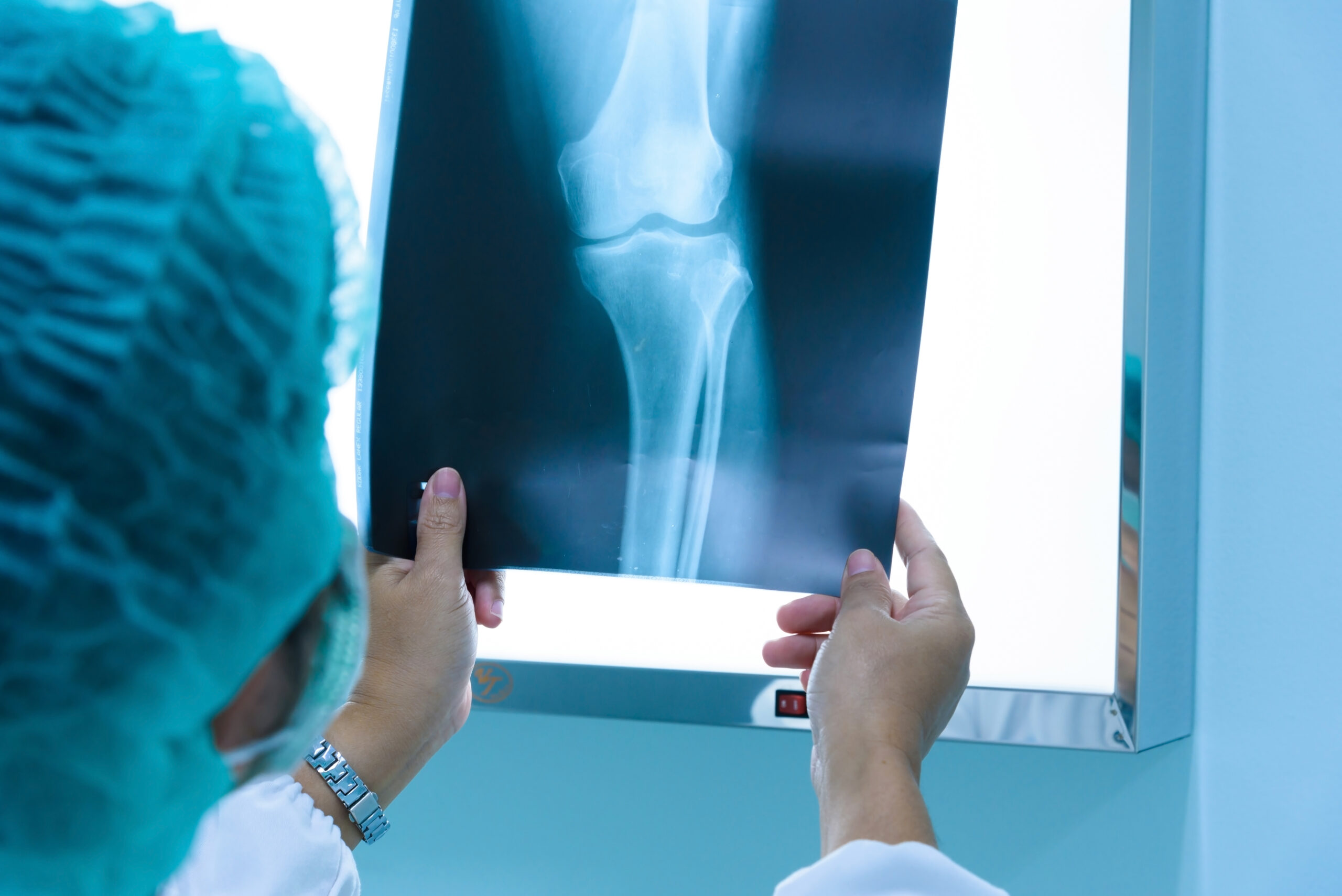 Imaging specialist reviewing X-ray image of leg